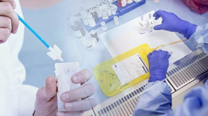 Sağlık Bakanlığından erken teşhis alarmı: 15 milyon kişiye kanser tarama SMS'i