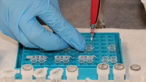 Kortizon nedir? Ne için kullanılır?