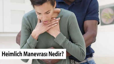 Heimlich Manevrası Nedir?