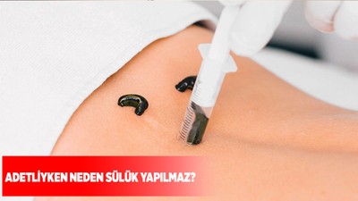 Adetliyken neden sülük yapılmaz?