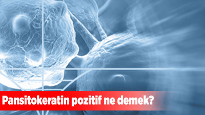 Pansitokeratin pozitif ne demek?