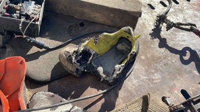 Ayağı halata sıkıştı, ayak parmakları koptu!