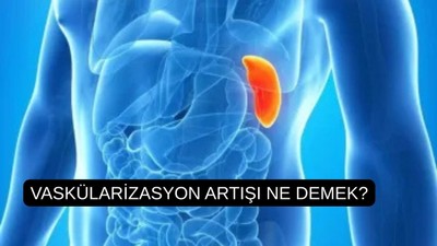 Vaskülarizasyon artışı ne demek?