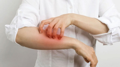 Anafilaksi nedir, neden olur, anafilaksi olduğumuzu nasıl anlarız?