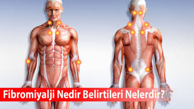 Fibromiyalji Nedir Belirtileri Nelerdir Fibromiyalji nedir?