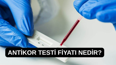 Antikor testi fiyatı nedir?