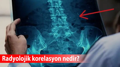 Radyolojik korelasyon nedir? Emar raporunda “Korelasyon önerilir” ne anlama geliyor?