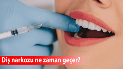 Diş narkozu ne zaman geçer?