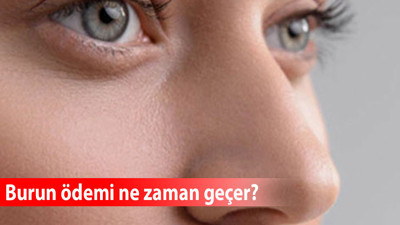 Burun ödemi ne zaman geçer?
