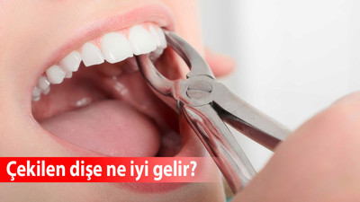 Çekilen dişe ne iyi gelir?
