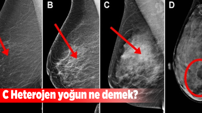 C Heterojen yoğun ne demek?