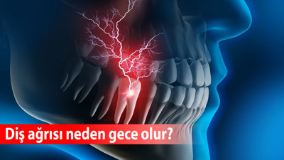 Diş ağrısı neden gece olur?