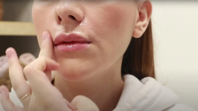 Vücut gelişiminde tüylenme neden olur?