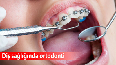 Diş sağlığında ortodonti: Tedavi süreçleri ve modern yaklaşımlar