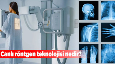 Canlı röntgen teknolojisi nedir?