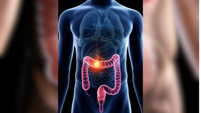 Diafuryl nedir? Kullanımı ve bilmeniz gereken diğer önemli bilgiler
