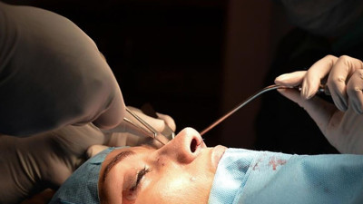 Burun törpüleme nedir? Ameliyat sonrası iyileşme sürecinde neler yapılmalı?