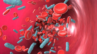 Sepsis nedir? Kanda enfeksiyon neden olur? Belirtileri nelerdir?