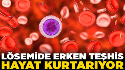 Lösemide erken teşhis hayat kurtarıyor!