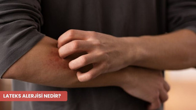 Lateks alerjisi nedir? Belirtileri ve korunma yolları nelerdir?