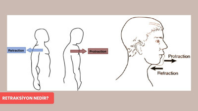Görünmeyen bir işaret: Retraksiyon, meme kanserinin erken sinyali olabilir!