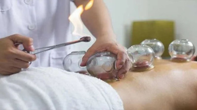 Hacamat yaptıktan sonra neler yenmez?