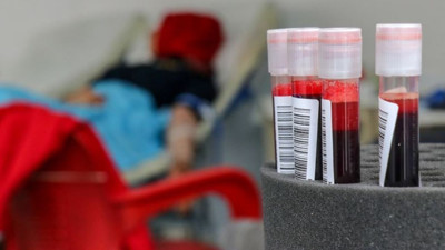 Kan tahlilinde NEU değeri ne anlama gelir?