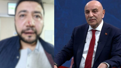 Keçiören'de personele dayak skandalı! Eski Belediye Başkanı Altınok'tan mobbing ve şiddet iddiası