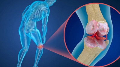 Osteoporoza karşı yapay zekâ destekli ilaç hamlesi