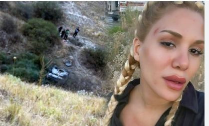 Survivor Almeda Baylan kaza geçirdi! - Resim: 3