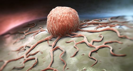 Bolsonaro'ya kanser teşhisi kondu - Resim: 2