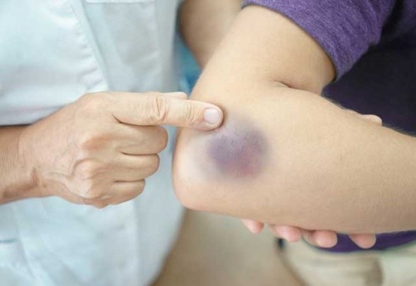 Kalbinizin düzgün çalışmadığını gösteren 8 işaret - Resim: 9