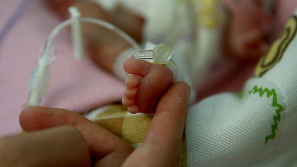 Türkiye’de prematüre gerçeği: Her 10 bebekten 1’i erken doğuyor