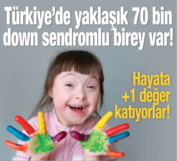 Türkiye'de yaklaşık 70 bin down sendromlu bireyin yaşadığı tahmin ediliyor