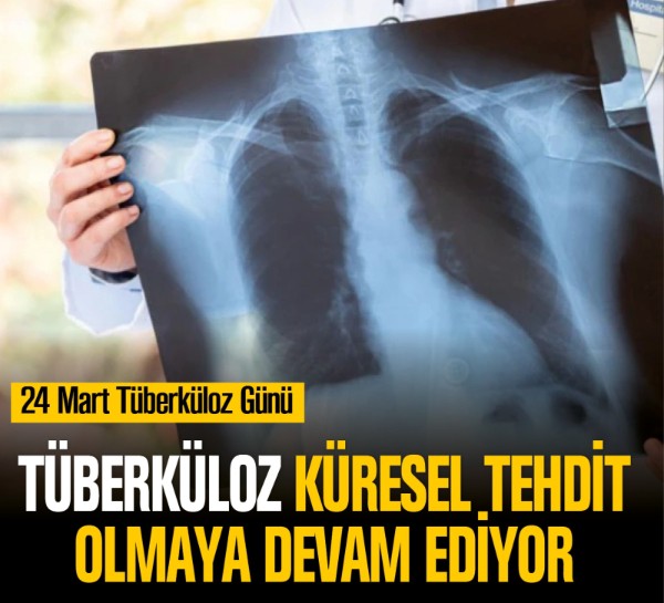 Tüberküloz küresel tehdit olmaya devam ediyor
