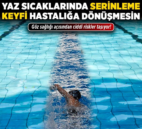 Yaz sıcaklarında serinleme keyfi hastalığa dönüşmesin: Göz sağlığı açısından ciddi riskler taşıyor!