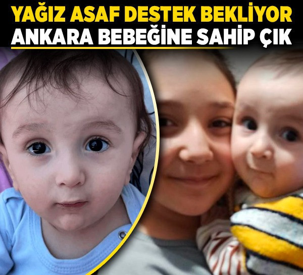 Yağız Asaf destek bekliyor! Ankara bebeğine sahip çık!