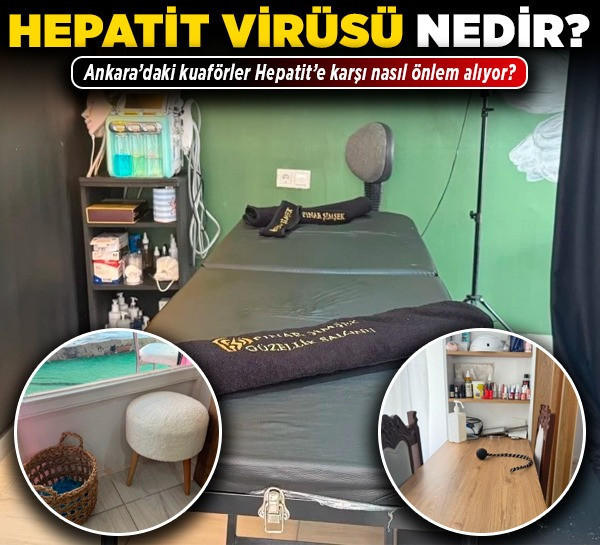 Hepatit virüsü nedir? Ankara’daki kuaförler Hepatit’e karşı nasıl önlem alıyor?