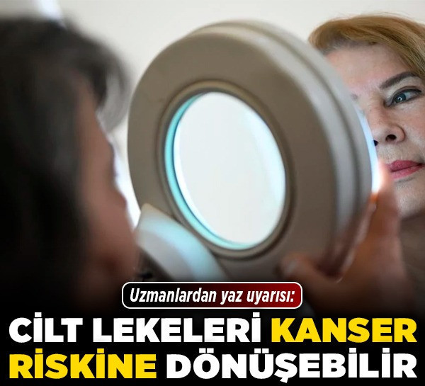 Uzmanlardan yaz uyarısı: Cilt lekeleri kanser riskine dönüşebilir!