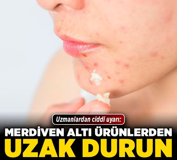 Uzmanlardan ciddi uyarı: Merdiven altı ürünlerden uzak durun!