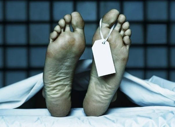 Ölmeden 3 Ay Öncesinde Bunlar Oluyor.! - Resim: 6