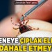 Uzmanlardan "kene" uyarısı: Keneye çıplak elle müdahale etmeyin!