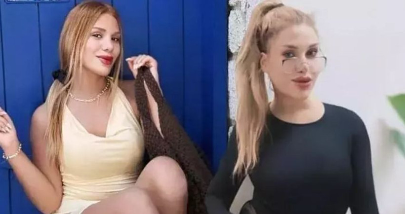 Survivor Almeda Baylan kaza geçirdi! - Resim: 2