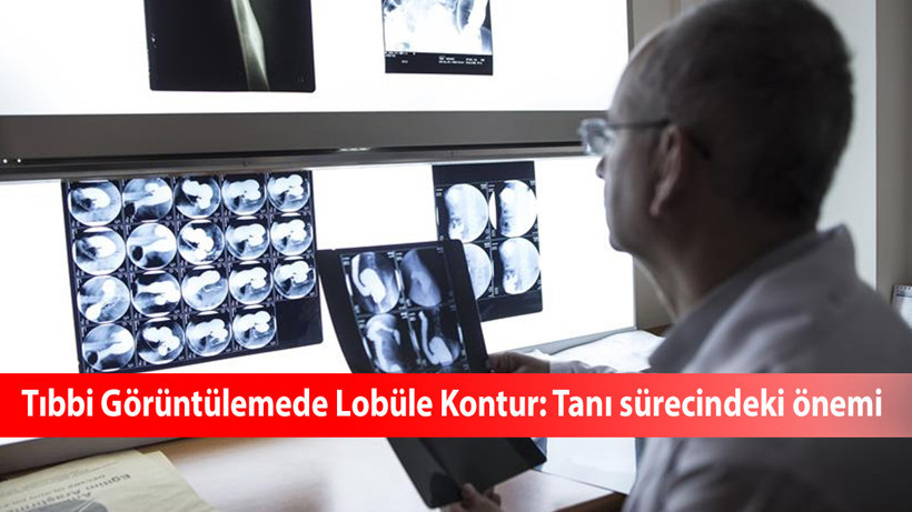 Tıbbi Görüntülemede Lobüle Kontur: Tanı sürecindeki önemi