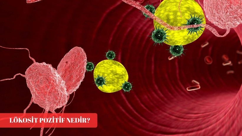 Lökosit pozitif nedir, kan tahlilinde lökosit yüksekliği ne anlama geliyor?