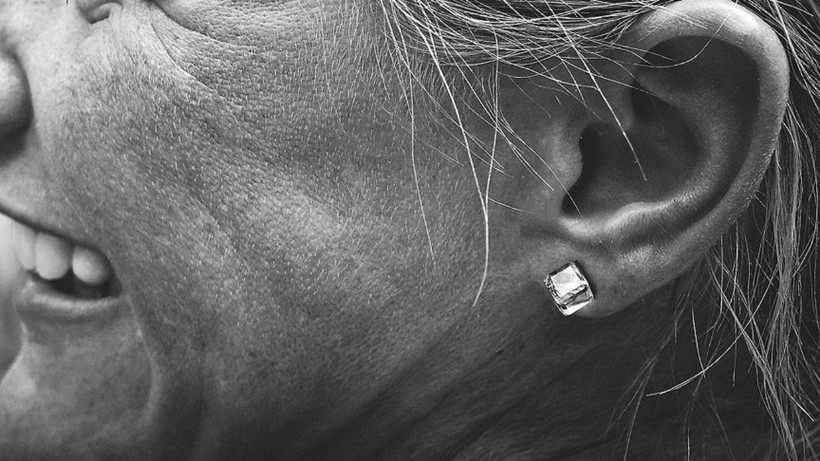 Kulakta yumuşak doku dansitesi nedir?