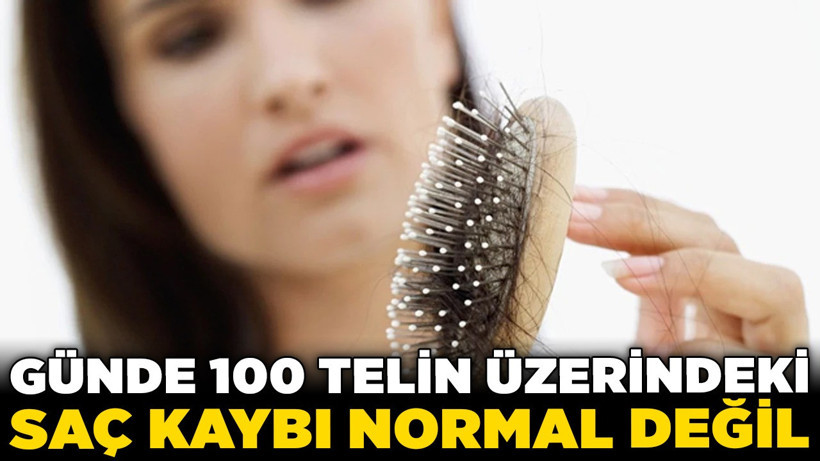Kadınlar aman dikkat: Günde 100 telin üzerindeki saç kaybı normal değil!